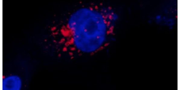 Protocolo desenvolvido por pesquisadores da Unicamp mostra o microrganismo se replicando na periferia do núcleo celular; metodologia ajuda a compreender a ação do SARS-CoV-2 e pode ser aplicada também no estudo de outros vírus — Foto: Luana Nunes Santos/Unicamp