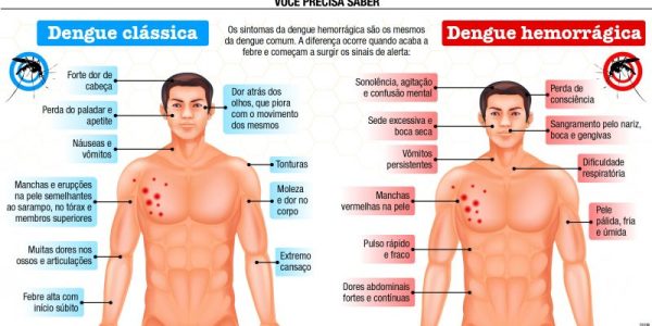 Print