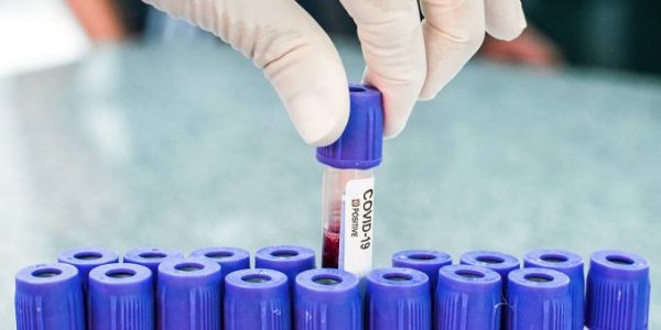 testes.exames.coronavirus-1[1]